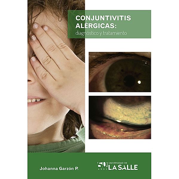 Conjuntivitis alérgicas, Sandra Johanna Garzón Parra