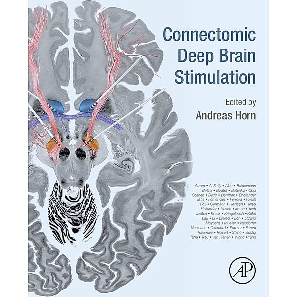 Connectomic Deep Brain Stimulation