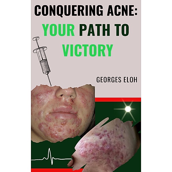 Conquering Acne: Your Path to Victory, Georges Eloh