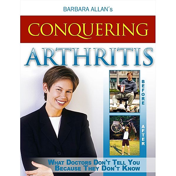 Conquering Arthritis: What Doctors Don't Tell You Because They Don't Know, Second Edition, Barbara Allan