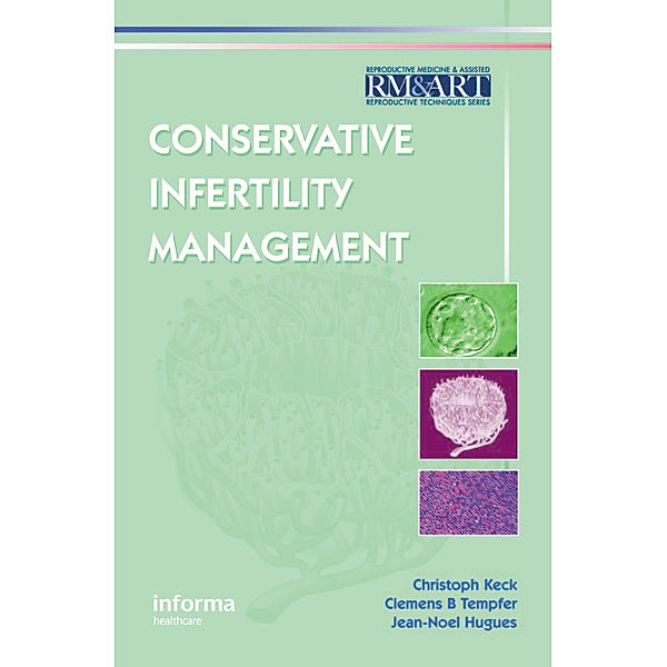Conservative Infertility Management, Christoph Keck, Clemens B. Tempfer, Jean Noel Hugues