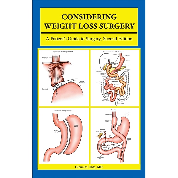 Considering Weight Loss Surgery, Glenn M. Ihde MD