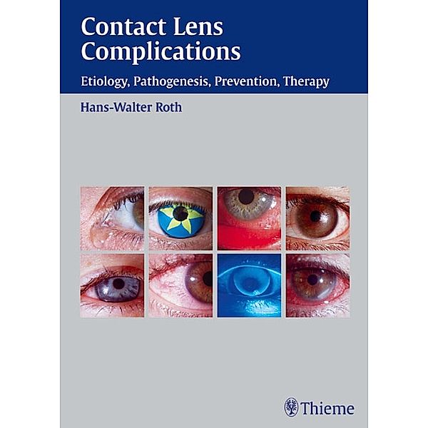 Contact Lens Complications, Hans-Walter Roth