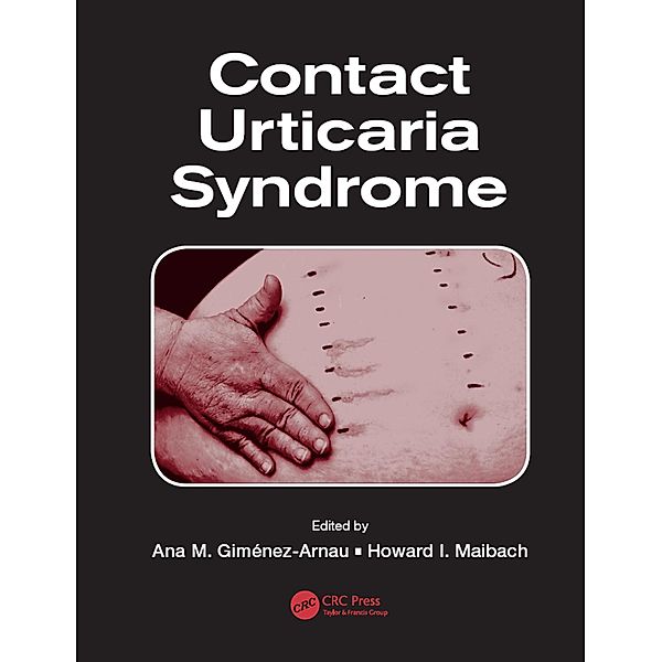 Contact Urticaria Syndrome