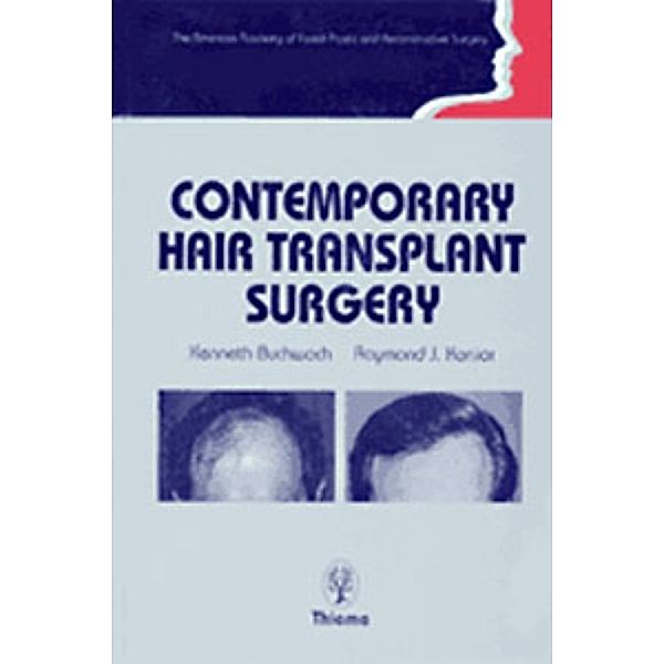 Contemporary Hair Transplant Surgery, Kenneth A. Buchwach, Raymond J. Konior