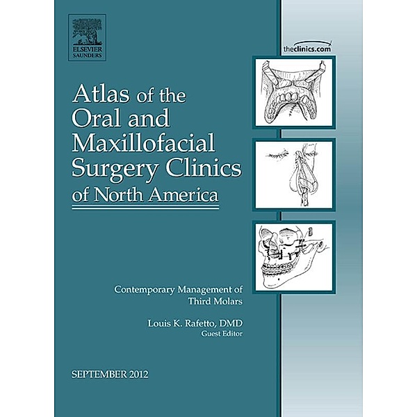 Contemporary Management of Third Molars, An Issue of Atlas of the Oral and Maxillofacial Surgery Clinics, Louis K. Rafetto