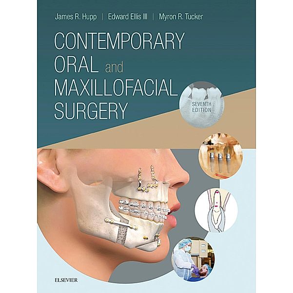 Contemporary Oral and Maxillofacial Surgery E-Book, James R. Hupp, Myron R. Tucker, Edward Ellis