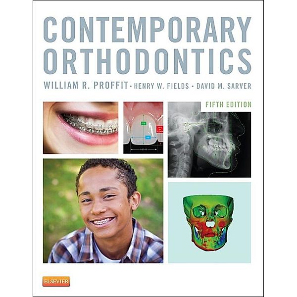 Contemporary Orthodontics - E-Book, William R. Proffit, Henry W. Fields, David M. Sarver