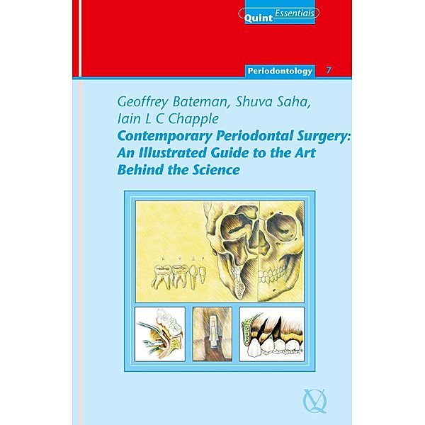 Contemporary Periodontal Surgery / QuintEssentials of Dental Practice Bd.21, Geoffrey Bateman, Shuva Saha, Iain L. C. Chapple