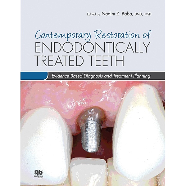 Contemporary Restoration of Endodontically Treated Teeth, Nadim Z. Baba