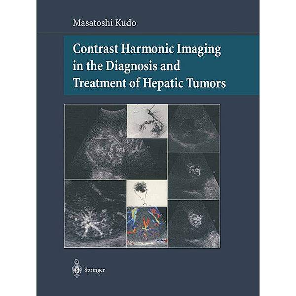 Contrast Harmonic Imaging in the Diagnosis and Treatment of Hepatic Tumors, Masatoshi Kudo