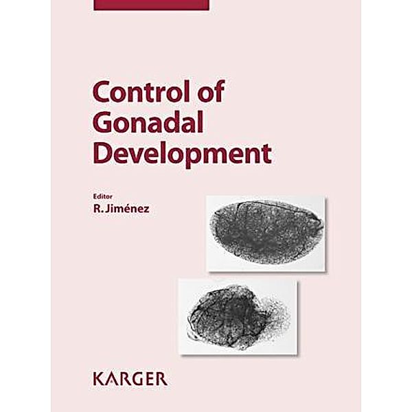 Control of Gonadal Development