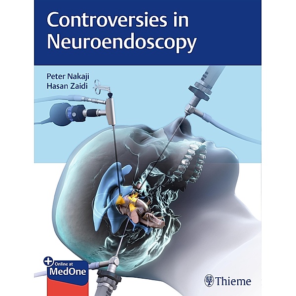 Controversies in Neuroendoscopy, Peter Nakaji, Hasan A. Zaidi