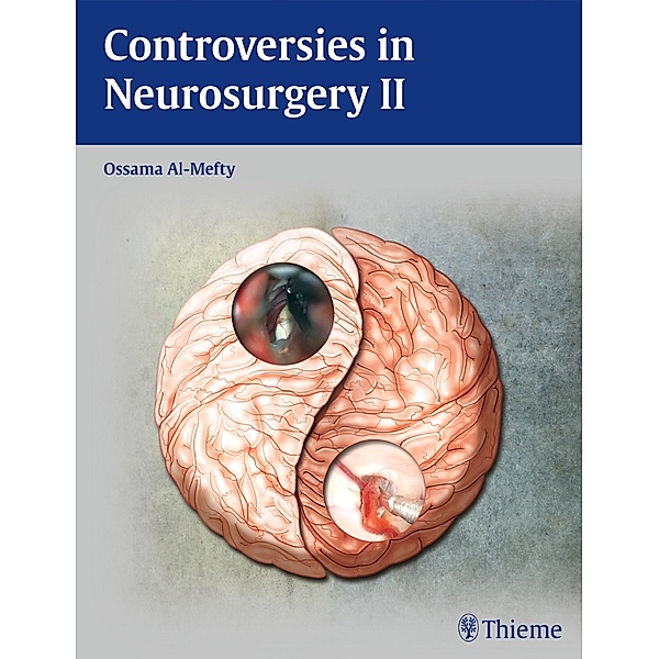 Controversies in Neurosurgery II..Vol.2, Ossama Al- Mefty, T. C. Origitano, H. L. Harkey