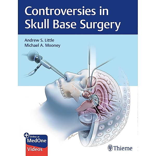Controversies in Skull Base Surgery, Andrew S. Little, Michael A. Mooney