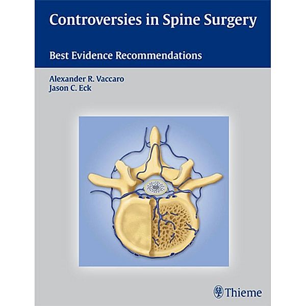 Controversies in Spine Surgery