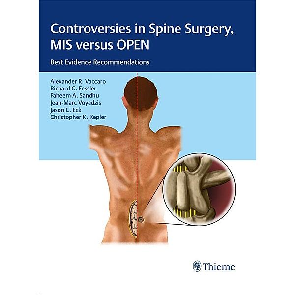 Controversies in Spine Surgery, MIS versus OPEN