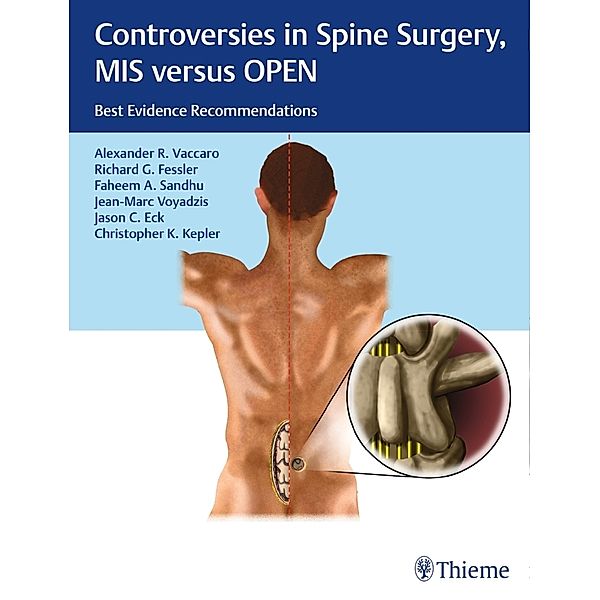 Controversies in Spine Surgery: MIS versus OPEN