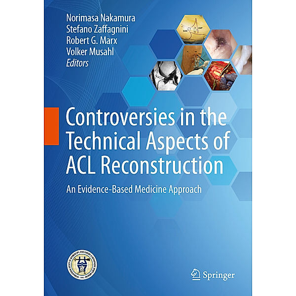 Controversies in the Technical Aspects of ACL Reconstruction