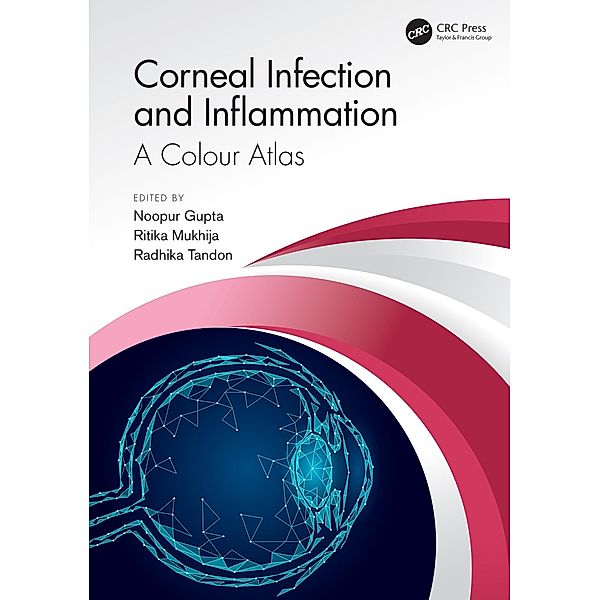 Corneal Infection and Inflammation