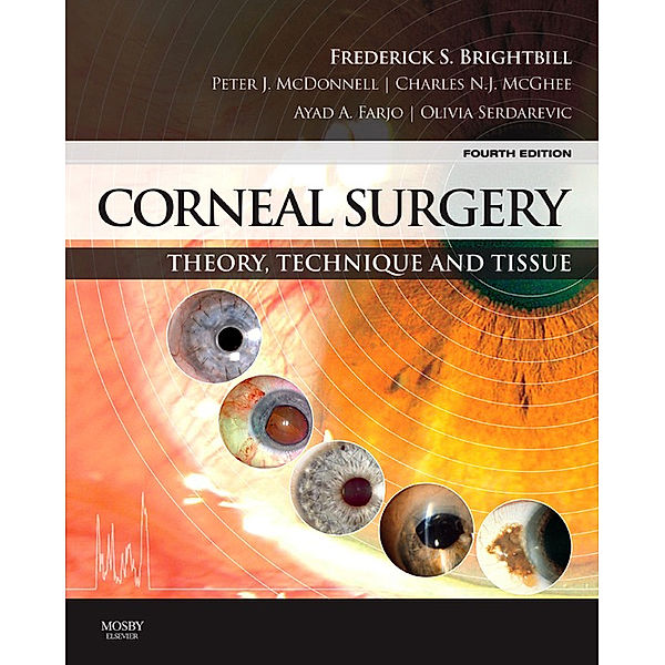 Corneal Surgery E-Book, Ayad A. Farjo, Charles N. J. McGhee, Frederick S. Brightbill, Olivia Serdarevic, Peter J. McDonnell