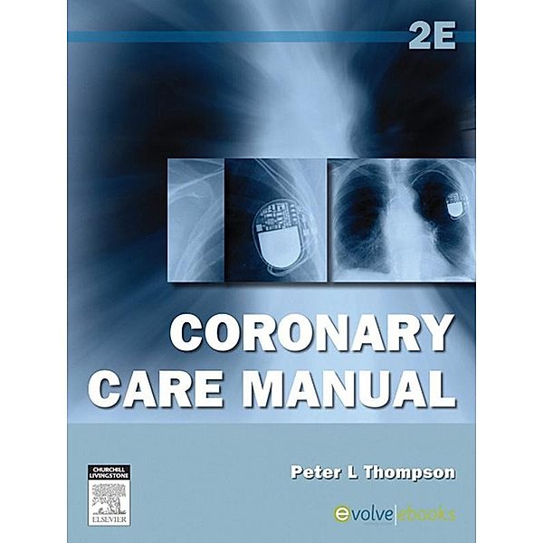 Coronary Care Manual, Peter L. Thompson