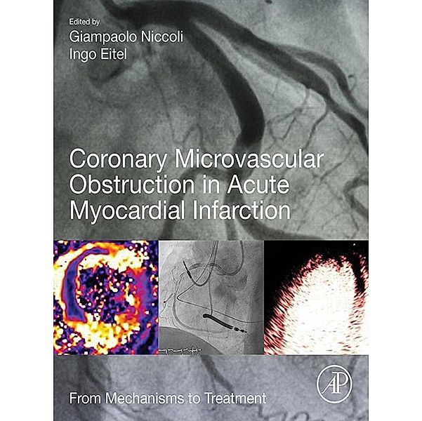 Coronary Microvascular Obstruction in Acute Myocardial Infarction