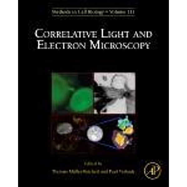 Correlative Light and Electron MIcroscopy
