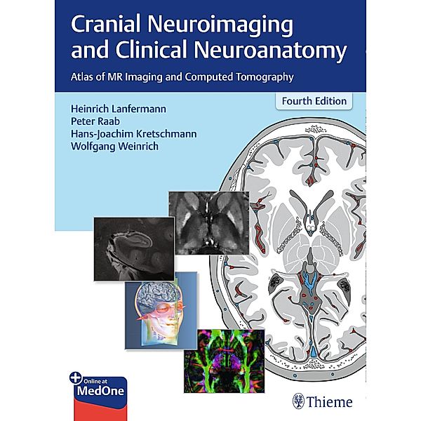 Cranial Neuroimaging and Clinical Neuroanatomy, Hans-Joachim Kretschmann, Wolfgang Weinrich