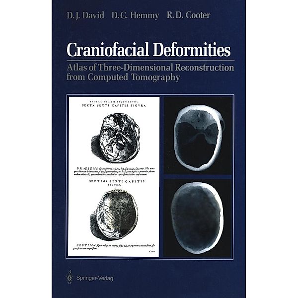 Craniofacial Deformities, David J. David, David C. Hemmy, Rodney D. Cooter