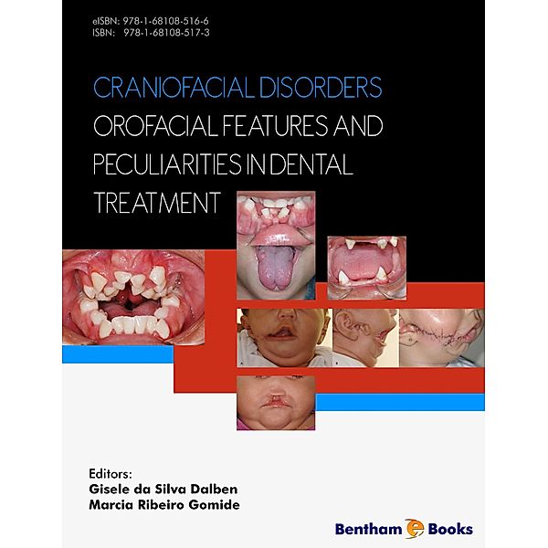 Craniofacial Disorders - Orofacial Features and Peculiarities in Dental Treatment