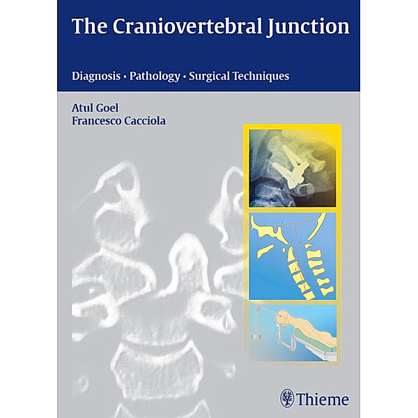 Craniovertebral Junction, Atul Goel, Francesco Cacciola