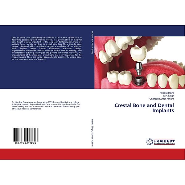 Crestal Bone and Dental Implants, Nivedita Bawa, S. P. Singh, Chandan Kumar Kusum