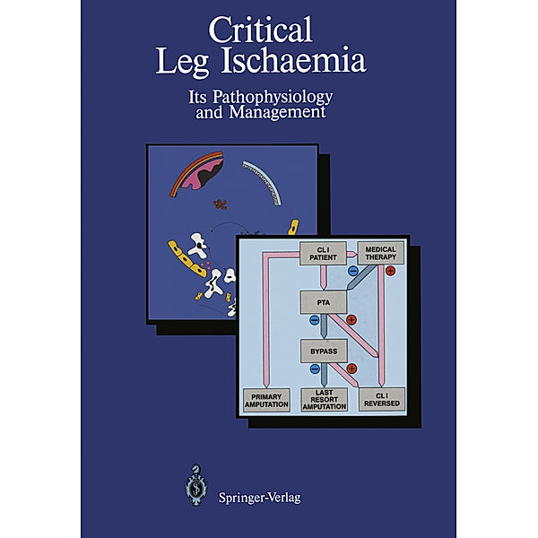 Critical Leg Ischaemia