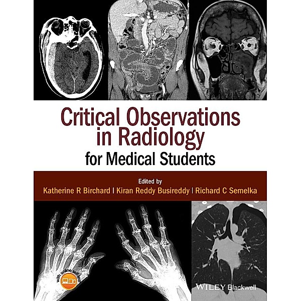Critical Observations in Radiology for Medical Students, Katherine R. Birchard, Kiran Reddy Busireddy, Richard C. Semelka