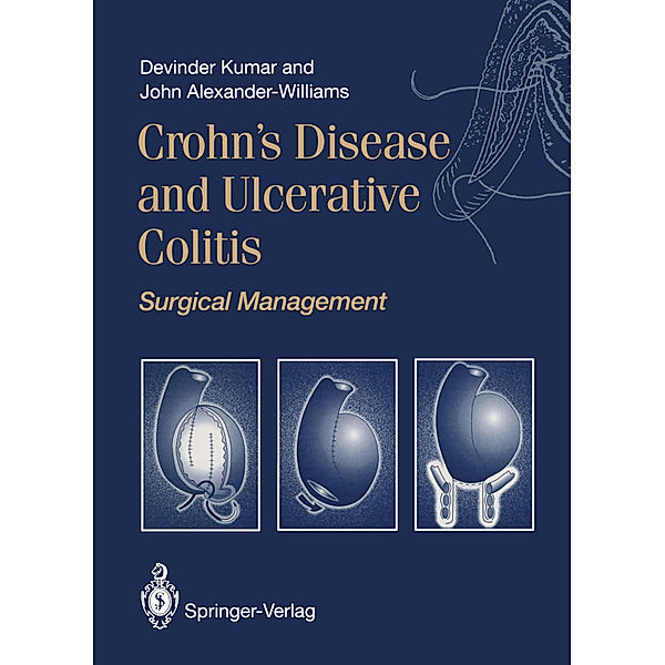Crohn's Disease and Ulcerative Colitis, Devinder Kumar, John Alexander-Williams