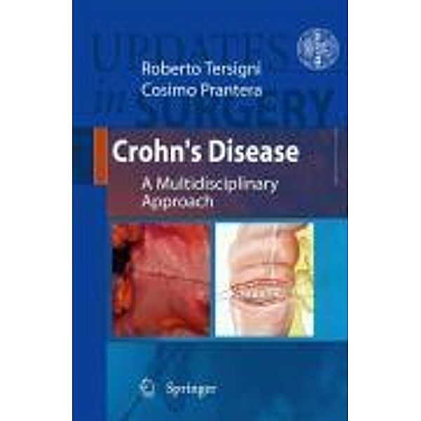 Crohn's Disease / Updates in Surgery, Cosimo Prantera, Roberto Tersigni