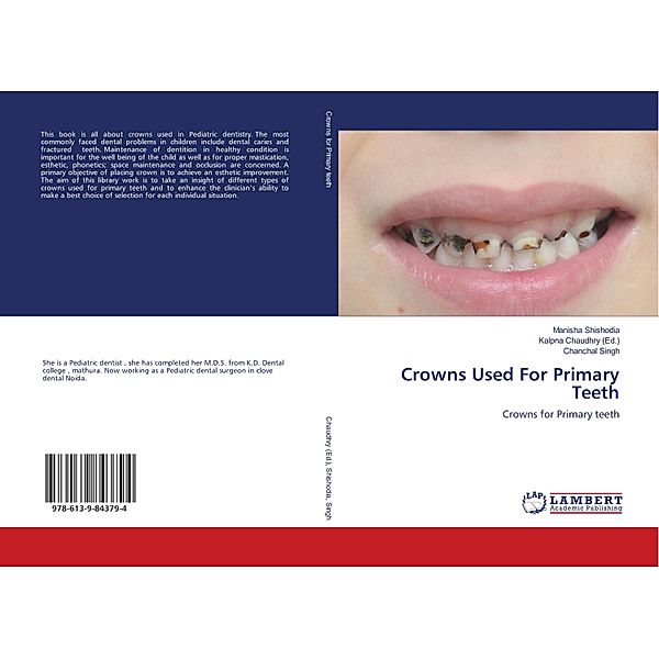 Crowns Used For Primary Teeth, Manisha Shishodia, Chanchal Singh