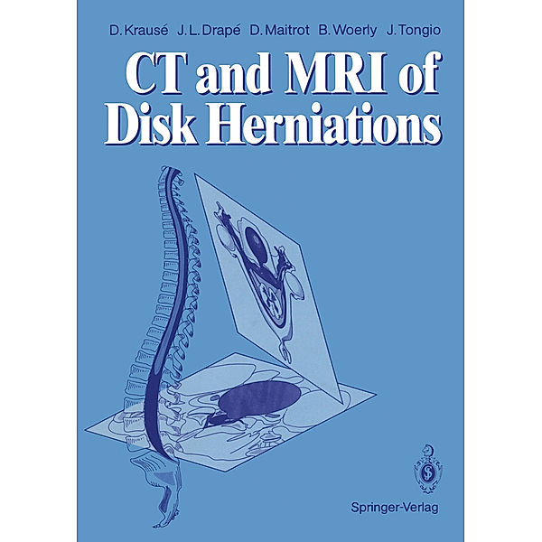 CT and MRI of Disk Herniations, Denis Krause, Jean L. Drape, Daniel Maitrot, Bernard Woerly, Jean Tongio