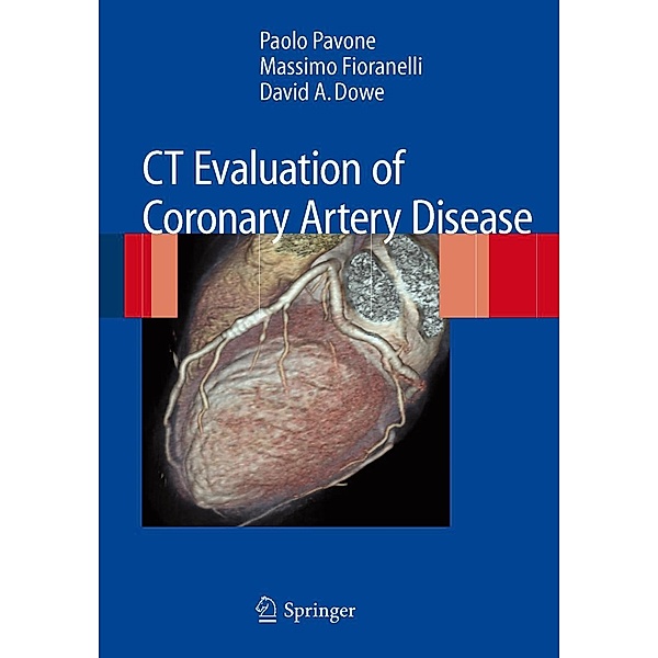 CT Evaluation of Coronary Artery Disease, Paolo Pavone, Massimo Fioranelli, David A. Dowe