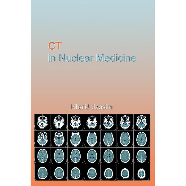 CT in Nuclear Medicine, Khalid Jassim