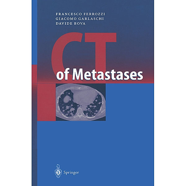 CT of Metastases, Francesco Ferrozzi, Giacomo Garlaschi, Davide Bova