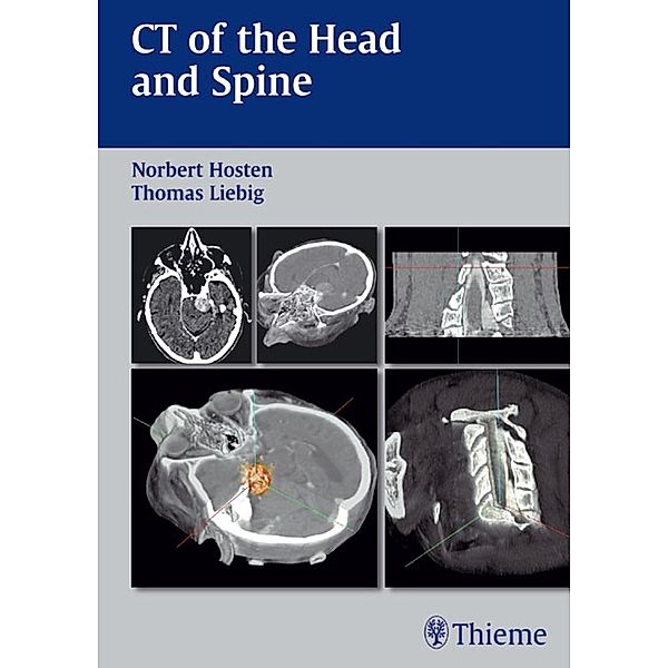 CT of the Head and Spine, Norbert Hosten, Thomas Liebig