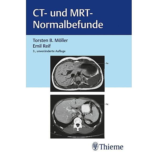 CT und MRT Normalbefunde, Torsten Bert Möller, Emil Reif