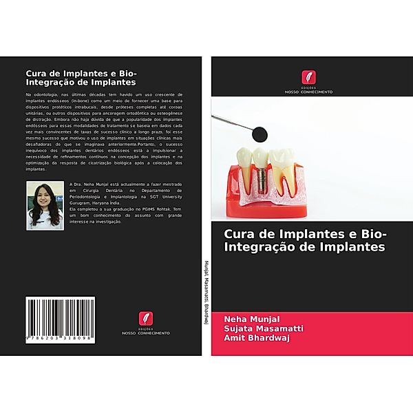 Cura de Implantes e Bio- Integração de Implantes, Neha Munjal, Sujata Masamatti, Amit Bhardwaj