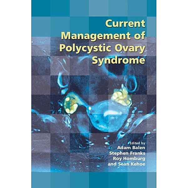 Current Management of Polycystic Ovary Syndrome