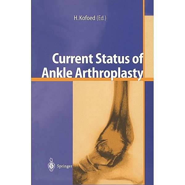 Current Status of Ankle Arthroplasty