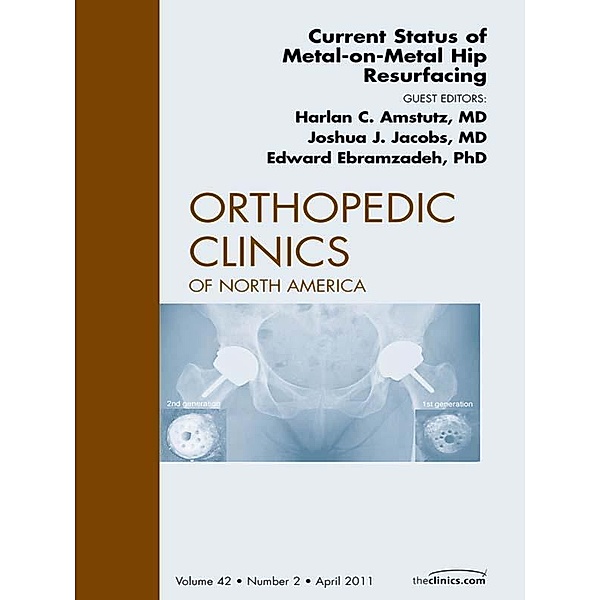 Current Status of Metal-on-Metal Hip Resurfacing, An Issue of Orthopedic Clinics, Harlan Amstutz, Joshua Jacobs, Eddie Ebramzadeh