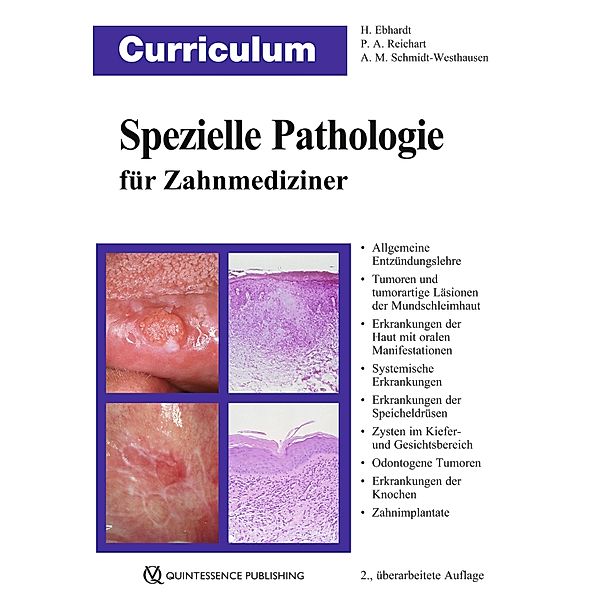 Curriculum Spezielle Pathologie für Zahnmediziner / Curriculum, Harald Ebhardt, Peter A. Reichart, Andrea Maria Schmidt-Westhausen
