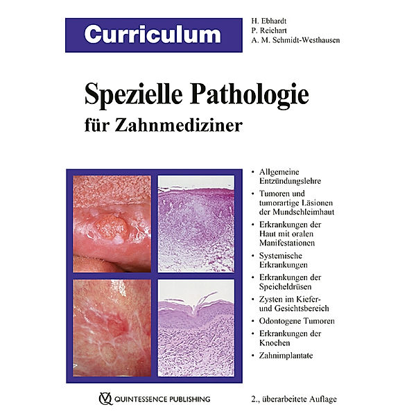 Curriculum Spezielle Pathologie für Zahnmediziner, Harald Ebhardt, Peter A. Reichart, Andrea Maria Schmidt-Westhausen